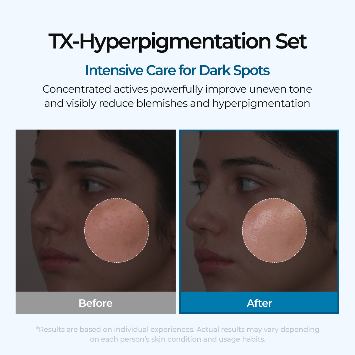 Dark Spot & Uneven Tone Peel Shot TX Duo
